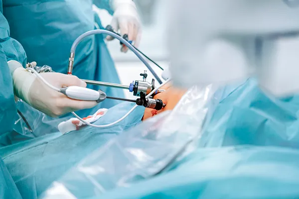 surgeons performing surgery