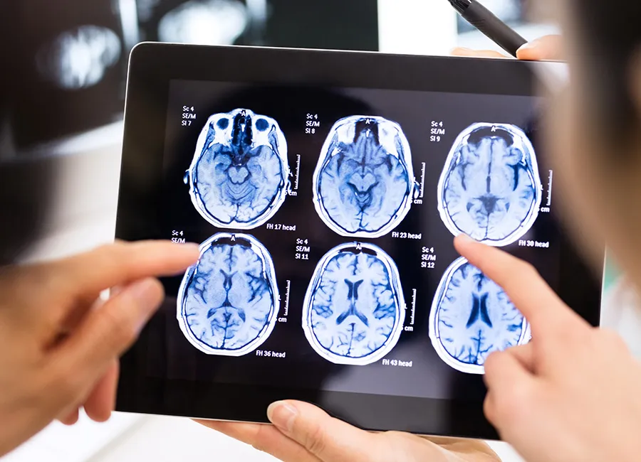 Close up of two people examining an MRI of a skull