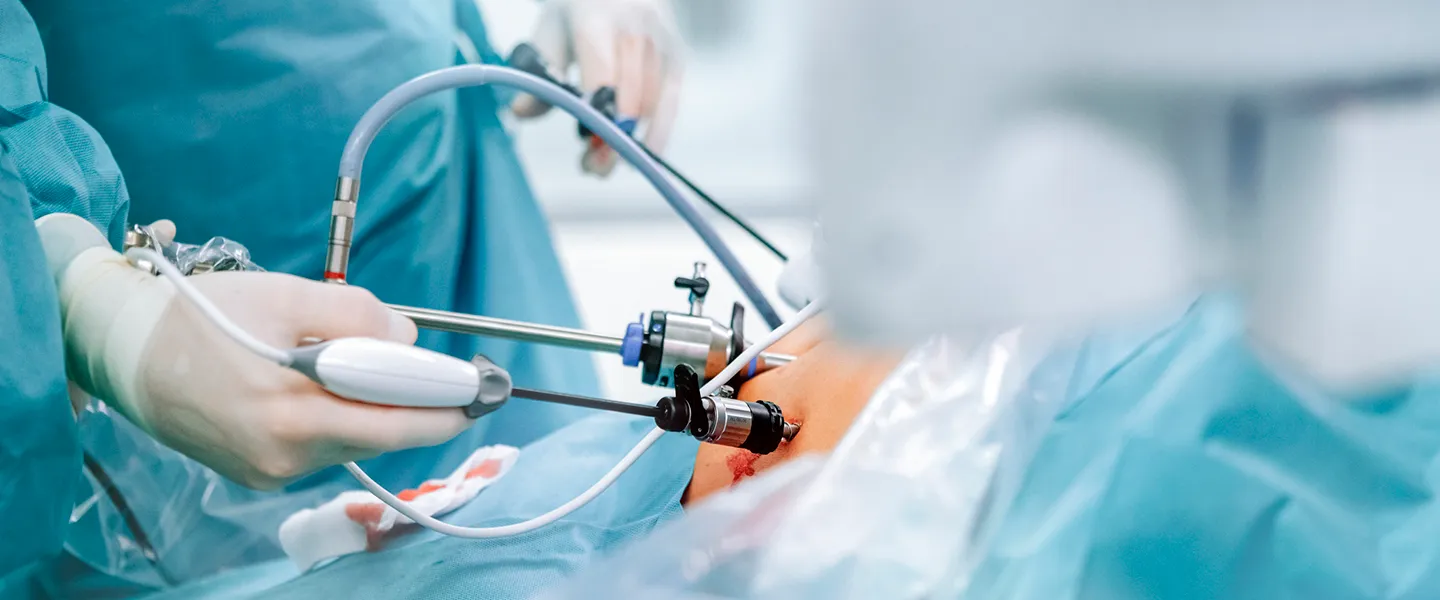 Laparoscopic Surgery_doctors performing Laparoscopic Surgery on abdomen